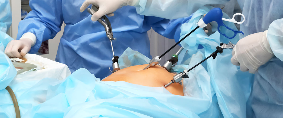 General & Laparoscopic Surgery